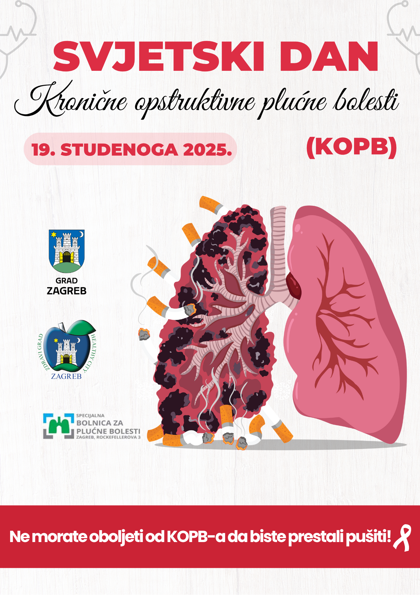 Kronične opstruktivne plućne bolesti